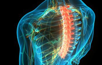Thoracic Spine Pain